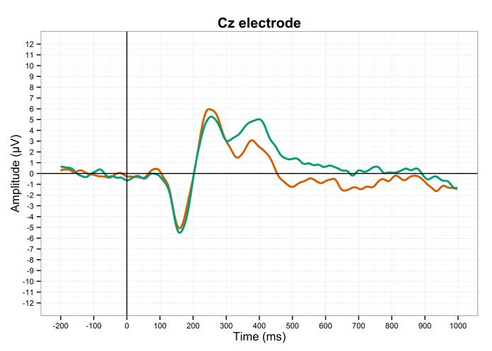 Cz electrode (RG onset timelock + NO GUIDE)