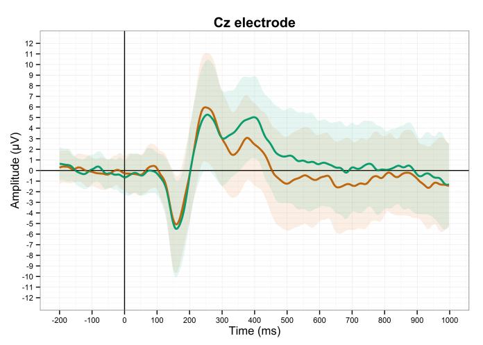 Cz electrode (RG onset timelock + SDs + NO GUIDE)