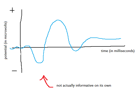 erp picture single line